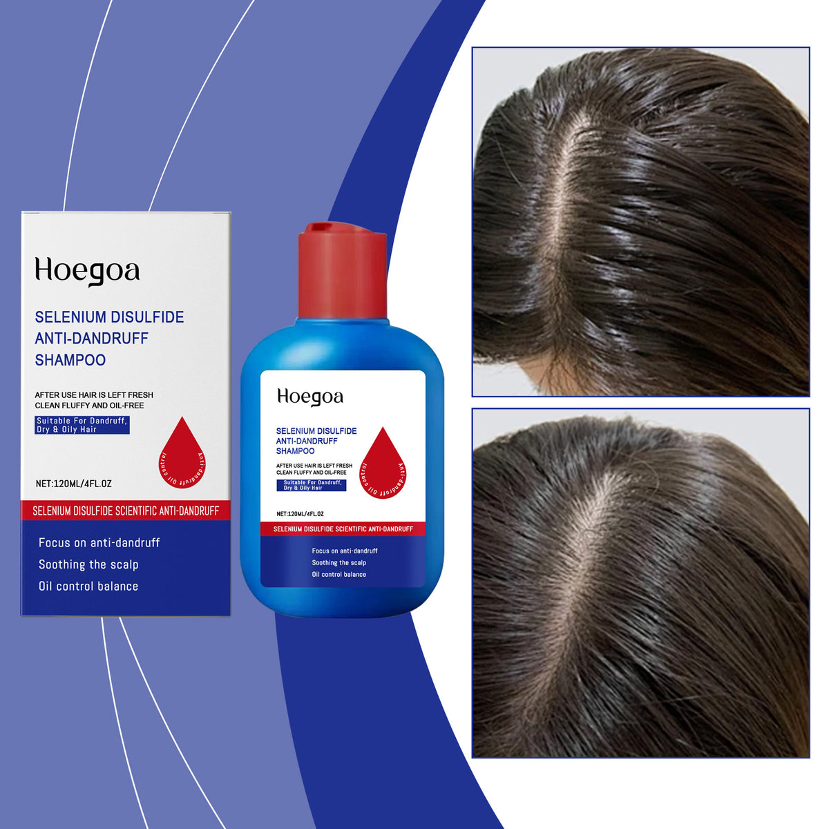 Selenium Disulfide Control Oil Shampoo 120ml