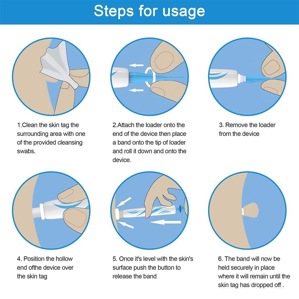 Painless Skin Tag Remover Facial Beauty Tool for Mole Wart Removal - Blue