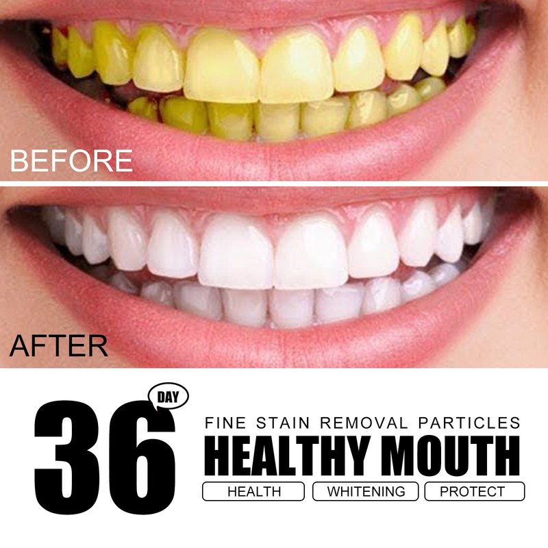 Powder for Stain Removal 30g - Dental Care