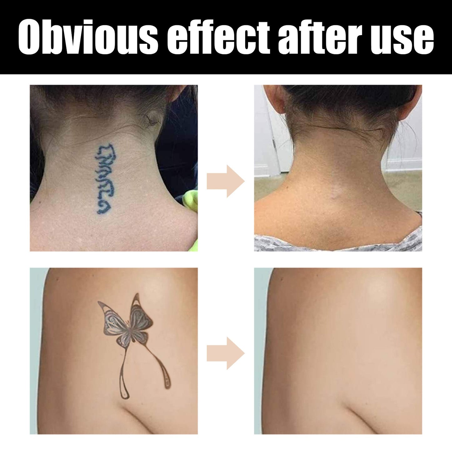 Professional Waterproof Tattoo Concealer for Body Scars and Dark Spots