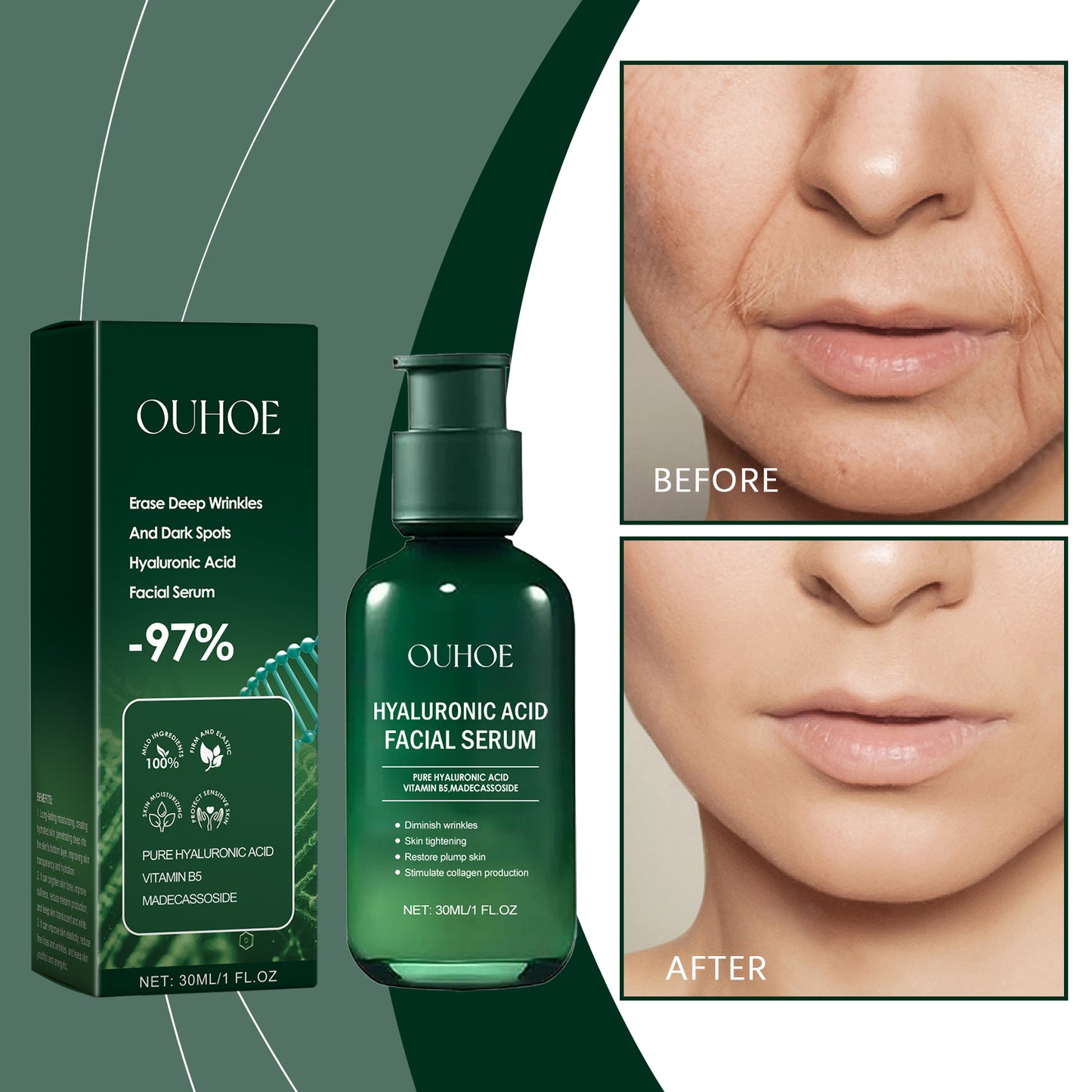 Niacinamide Facial Essence Serum - Moisturizing & Anti-Aging Skin Care 30ml