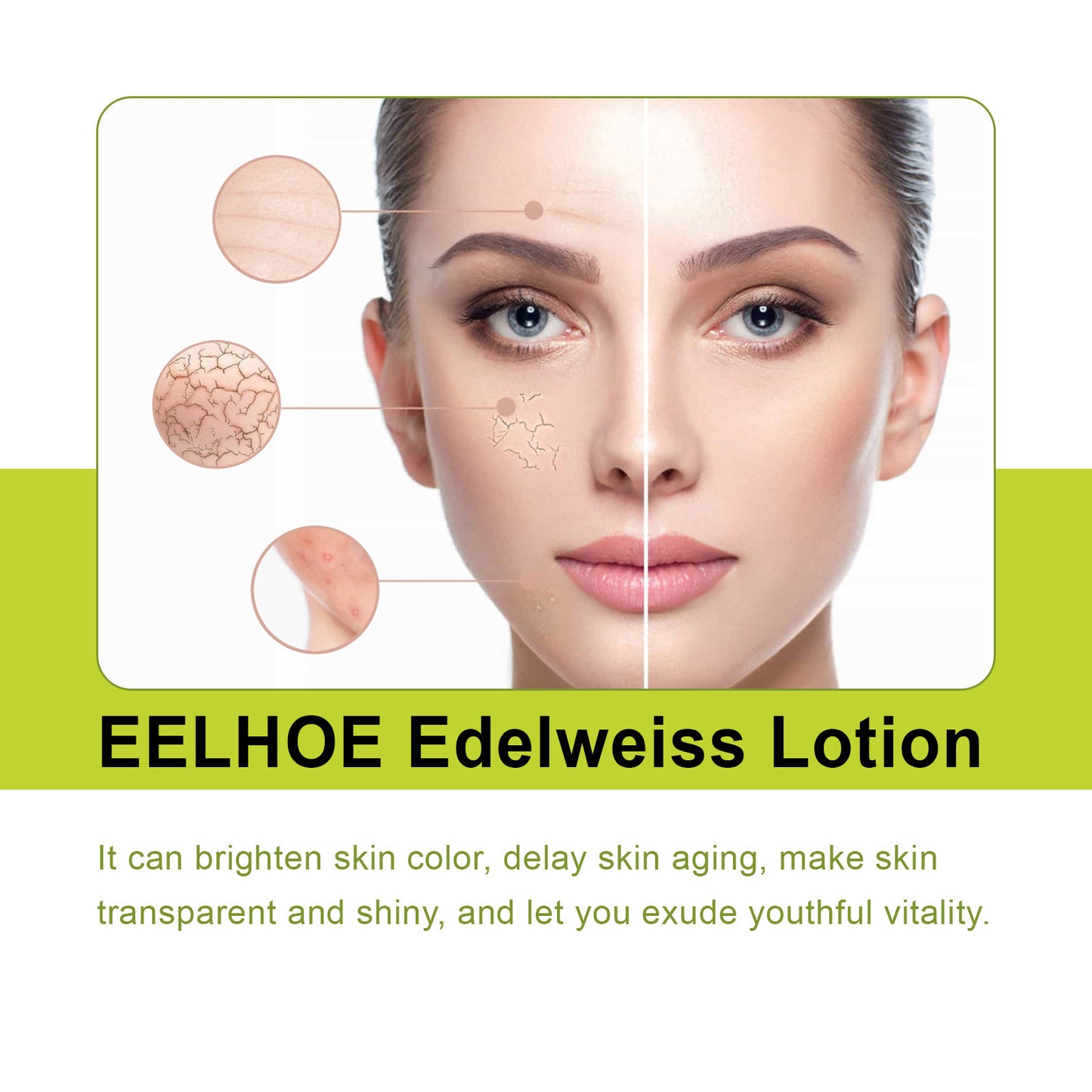 Edelweiss Brightening Face Lotion - Moisturizing Skin Care for Youthful Glow