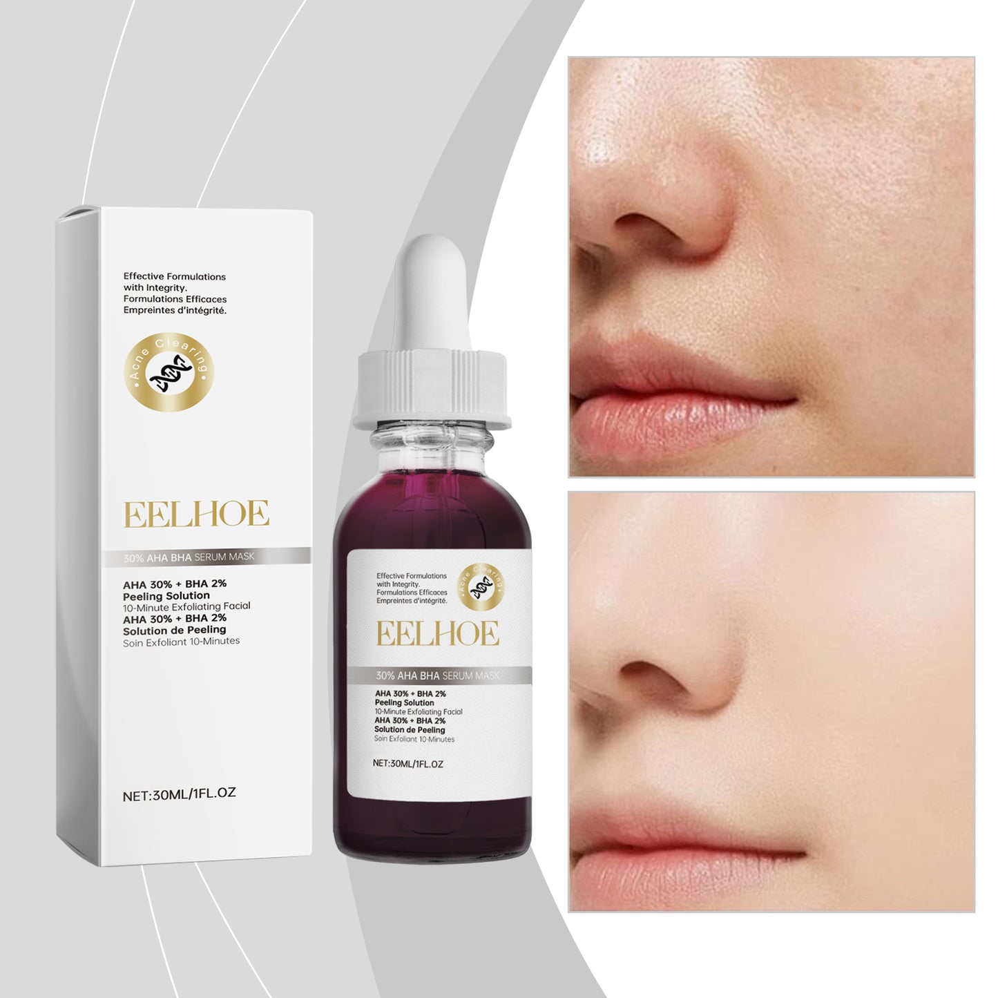 30% Fruit & Salicylic Acid Facial Essence - Moisturizing Skin Care Serum