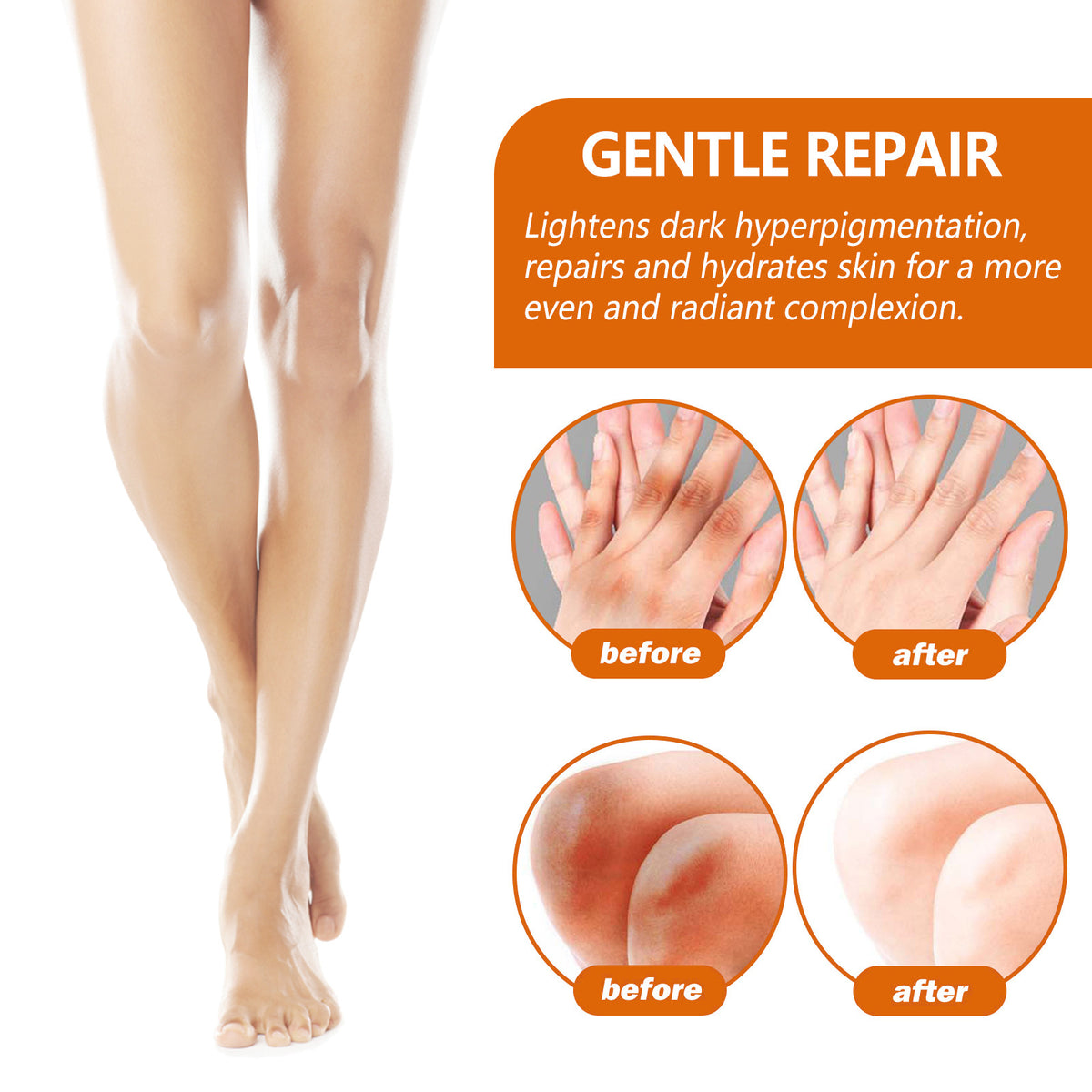 Black Ratchet Repair Joint Whitening Brightening