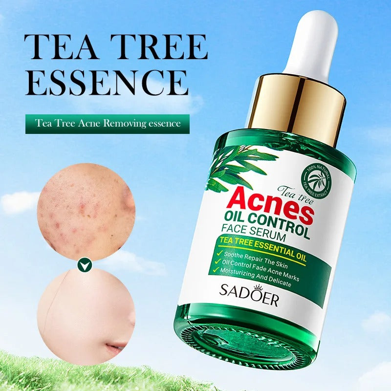 Tea Tree Hydrating Acne Control Facial Essence - 30ml