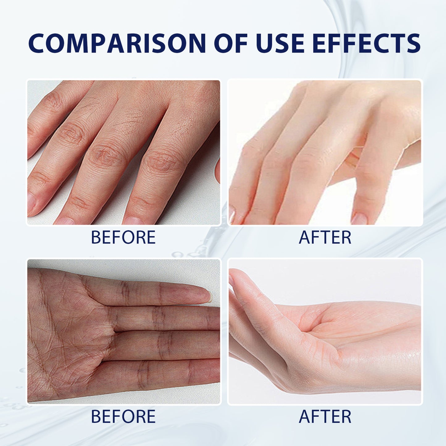 Aloe Vera Hand Care Gel - Hydrating Moisturizer for Dry & Cracked Skin