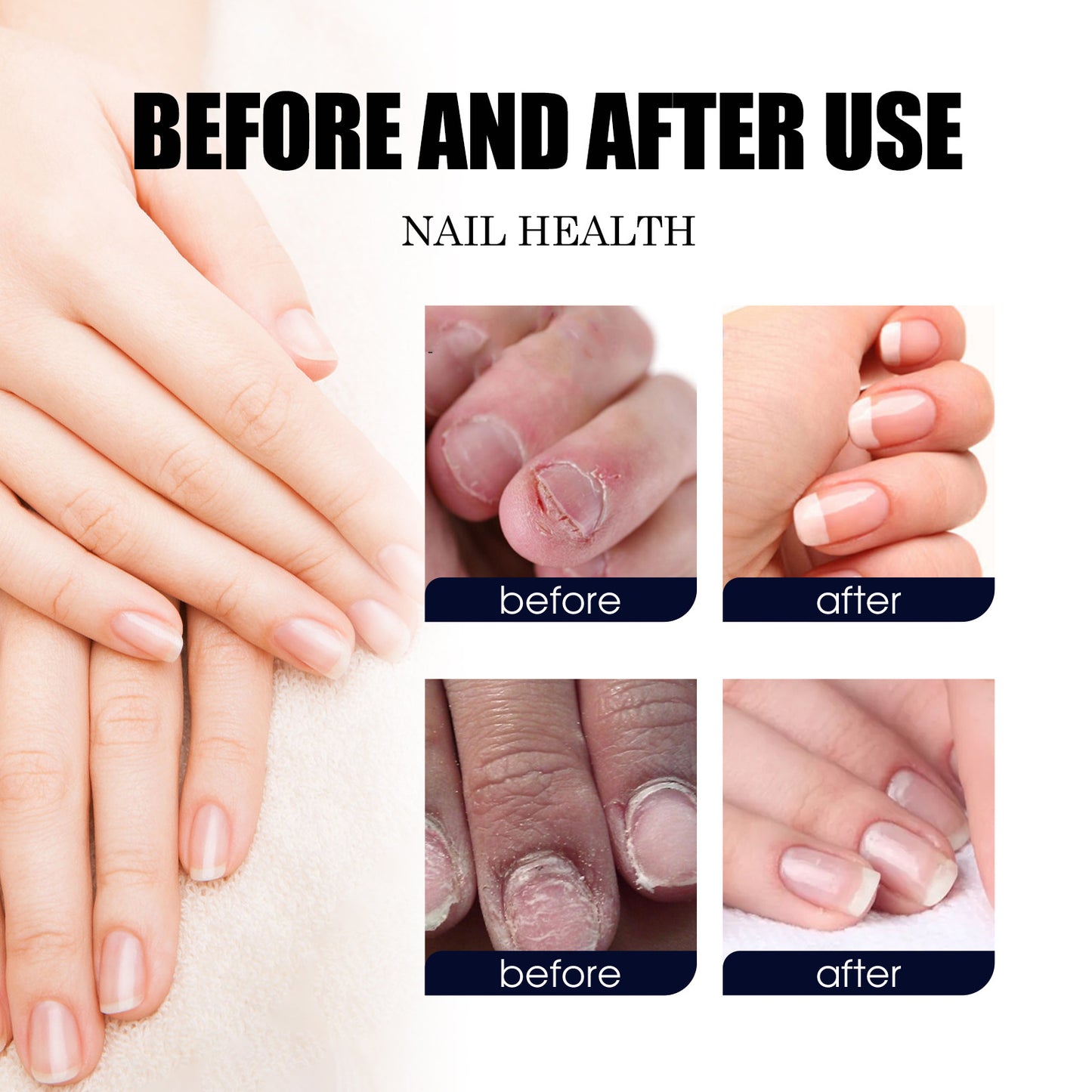 Nail Care Solution Repair Hand & Foot Softening Brightening 10ML